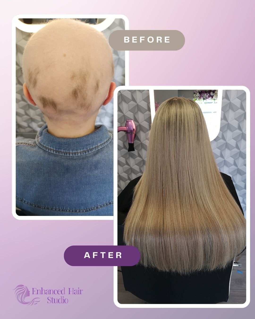 Enhanced Hair Studio client before and after her custom hair solution