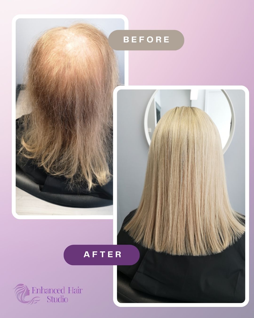 Light blonde Enhanced Hair Studio client before and after her fitted hair solution