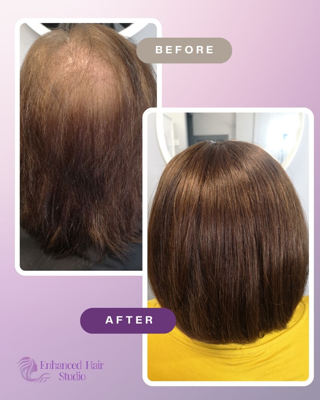 Enhanced Hair Studio client before and after her colour-matched hair solution