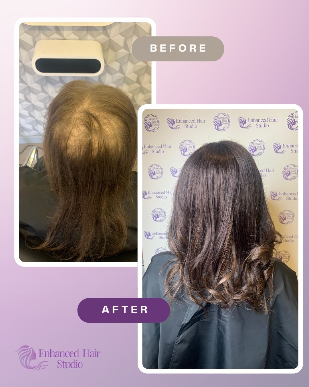 Brunette Enhanced Hair Studio client before and after her fitted hair solution
