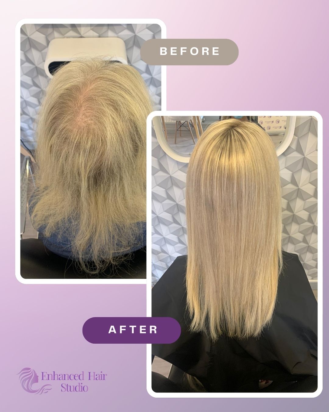 Blonde Enhanced Hair Studio client before and after her fitted hair solution