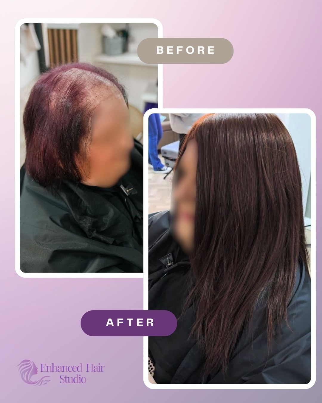 Enhanced Hair Studio client before and after her fitted hair solution